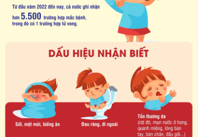 Dấu hiệu nhận biết bệnh tay chân miệng (1)